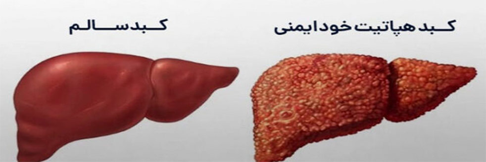 عکس کبد هپاتیت خود ایمنی